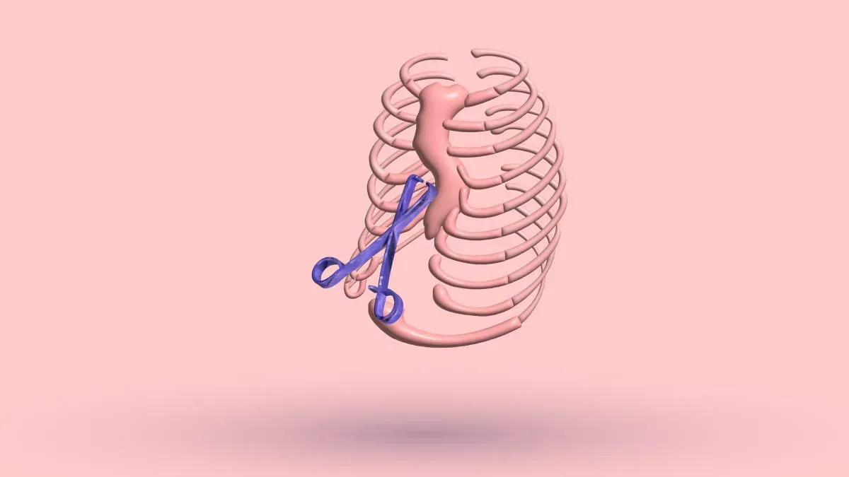 Does Pectus Excavatum Go Away On Its Own?: What To Do