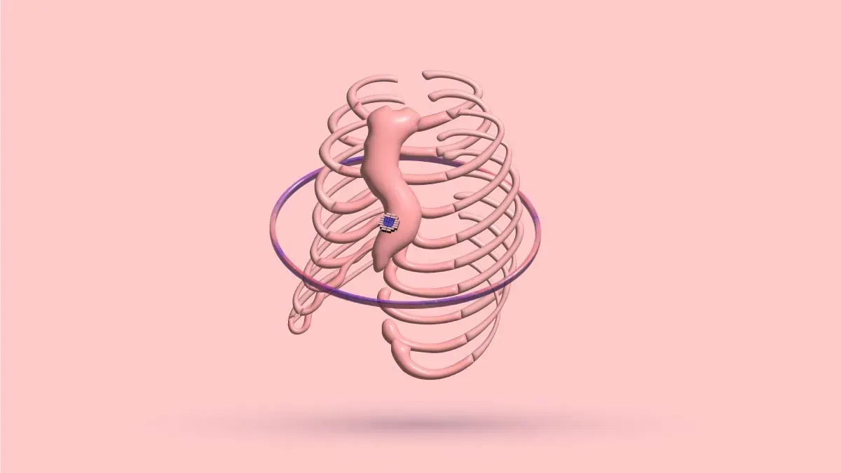 How To Prevent Pectus Excavatum Recurrence After Surgery