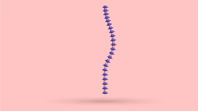 Pectus Excavatum Scoliosis: 7 Problems, Risks + More