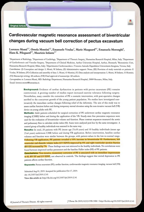 Cardiovascular magnetic resonance assessment of biventricular changes during vacuum bell correction of pectus excavatum