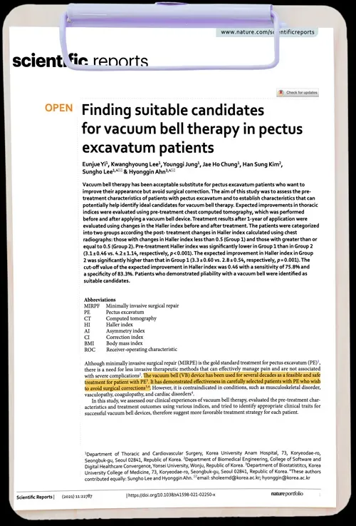 Finding suitable candidates for vacuum bell therapy in pectus excavatum patients