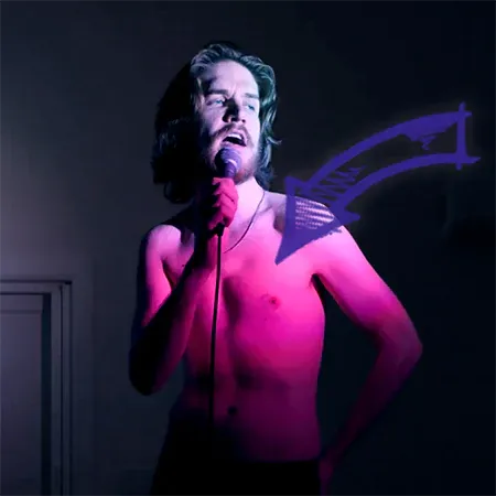Bo burnham pectus excavatum deformity