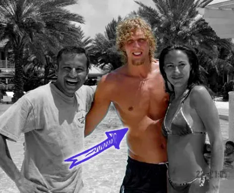 Dirk nowitzki naked pectus excavatum chest deformity