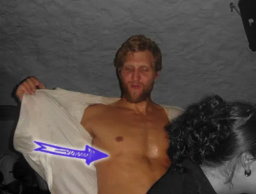 Dirk nowitzki shirtless chest deformity
