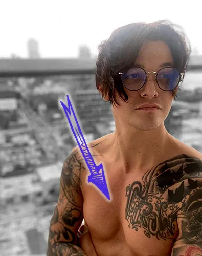Dj ghastly pectus excavatum chest deformity