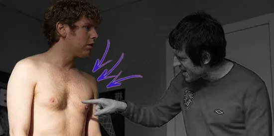 Josh widdicombe pectus excavatum chest deformity