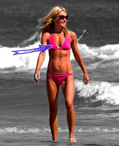 Kelly ripa chest deformity before surgery