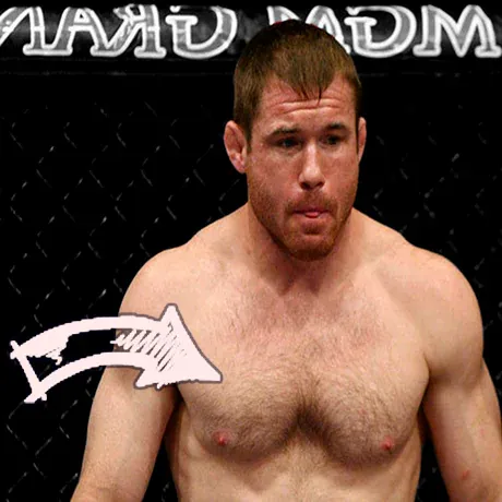 Matt hughes chest cavity weird