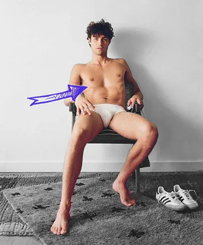 Miles mcmillan pectus excavatum chest wall deformity