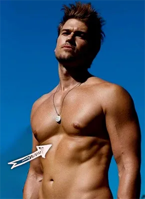 Nick zano pectus excavatum chest deformity