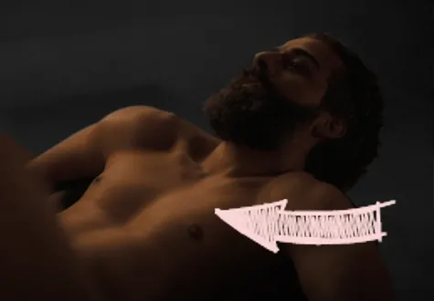 Oscar isaac pectus excavatum inverted chest