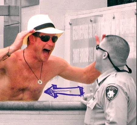 Prince harry chest deformity