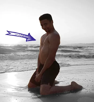 Tsm myth chest deformity pectus excavatum