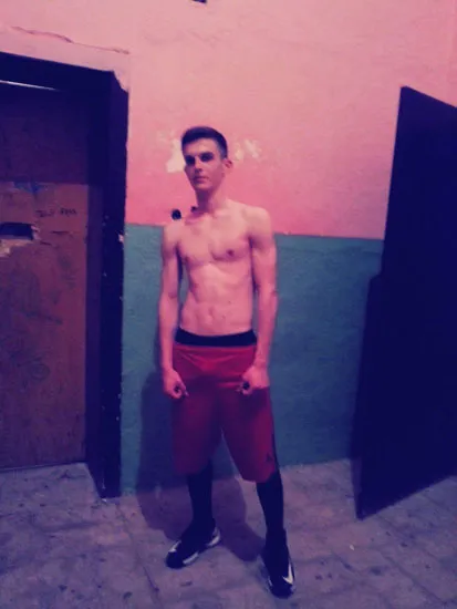 How my pectus excavatum journey started mihail veleski