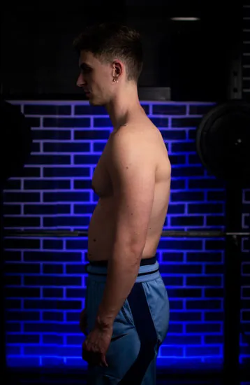 Pectus excavatum kyphosis