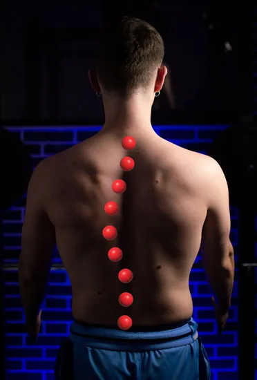 Levoscoliosis