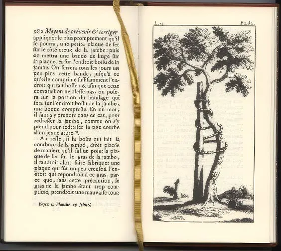 The crooked tree emblem of orthopedics, from Nicolas Andry’s book, a young tree tied to a straight stake